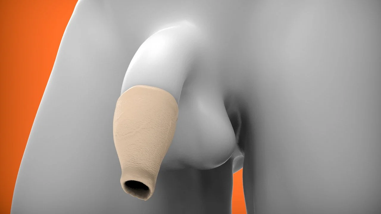 Oxballs Hood Moreskin Foreskin Set - Image 5